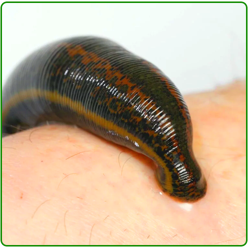 Raktmokshan Leech Therapy